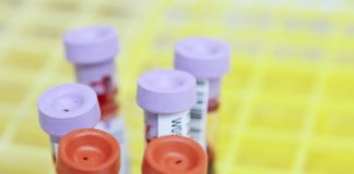 Study subjects needed for ground-breaking prostate cancer detection test